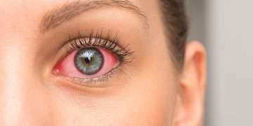 Public health officials in Michigan investigate five cases of EYE SYPHILIS in women who had sex with super-spreader man