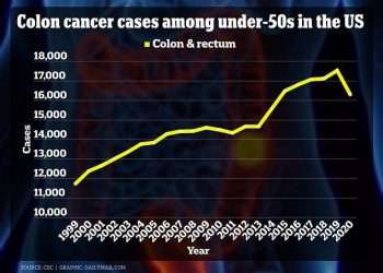What’s causing colon cancer epidemic in young people? Scientists launch $25m global probe to find the answer