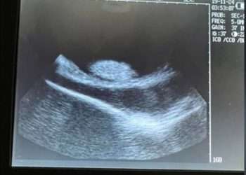 Bizarre new twist in Charlotte the virgin stingray saga that captivated America: ‘The narrative is no longer defendable’