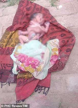 Tragic baby is born with four legs, four arms and two faces – in one-of-a-kind phenomenon