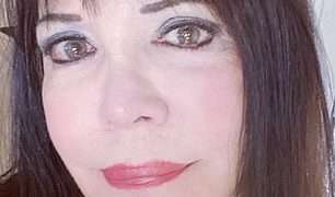 Florida mother is BLINDED and unable to shut her eyes after botched $13,000 facelift