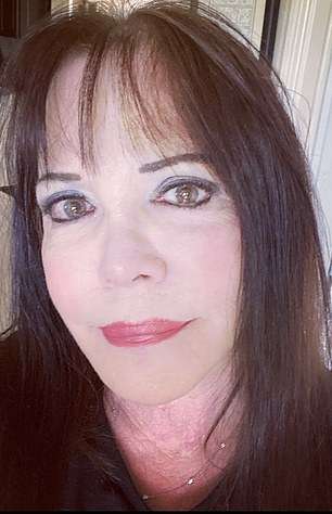 Florida mother is BLINDED and unable to shut her eyes after botched $13,000 facelift