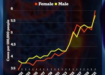 Condition suffered by 100million Americans raises risk of early colon cancer by up to 65%