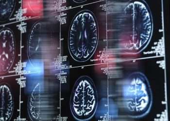 Common viral infection can trigger Alzheimer’s, shock new research suggests – raising hope that a cheap, widely available drug could prevent deadly disease