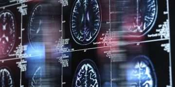 Common viral infection can trigger Alzheimer’s, shock new research suggests – raising hope that a cheap, widely available drug could prevent deadly disease