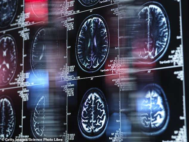 Common viral infection can trigger Alzheimer’s, shock new research suggests – raising hope that a cheap, widely available drug could prevent deadly disease