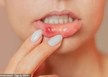 DR ELLIE: My mother is plagued by mouth ulcers – can we find her a remedy?