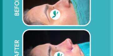 Trusted by Thousands: Luviacure’s Patient-Centered Approach Transforms Medical Tourism