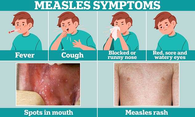 Surprising jab-dodging area where HALF of children aren’t vaccinated against measles…as cases surge across UK