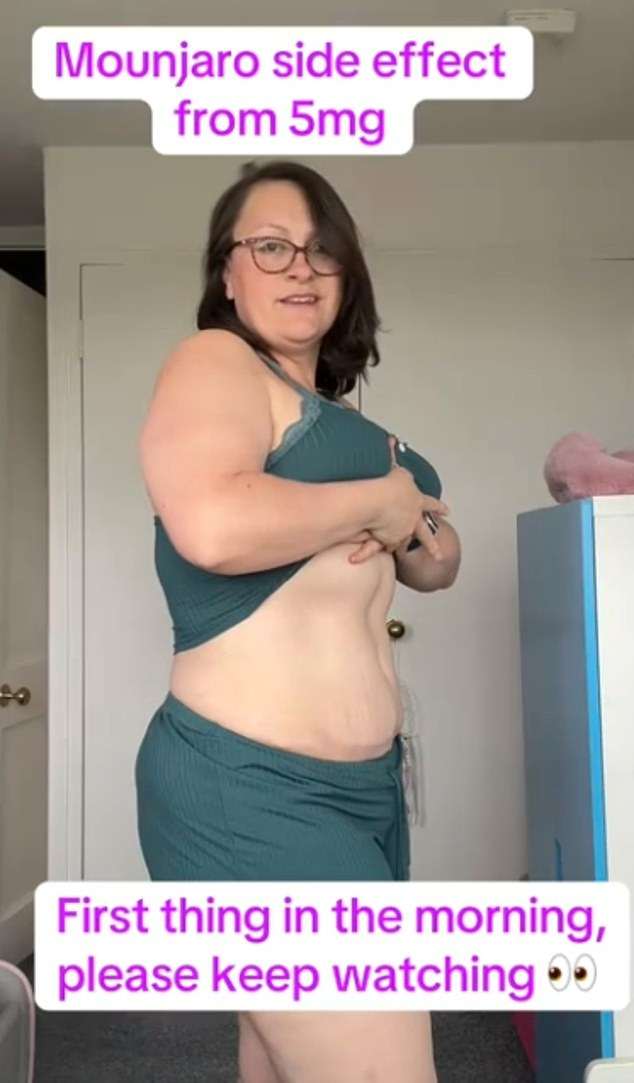 Mounjaro users horrified as bizarre side effect triggers apparent weight GAIN: ‘feels like I’m expanding’