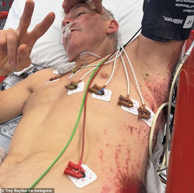 Aussie sporting legend is unrecognisable after shocking accident saw him hospitalised with serious injuries