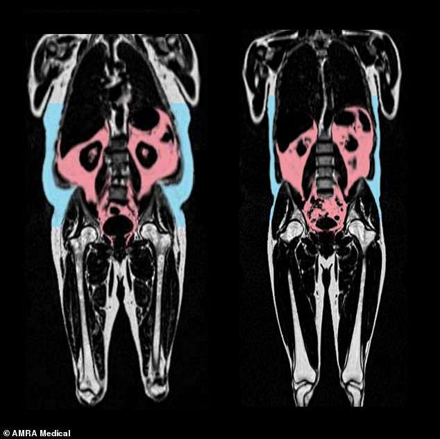 ‘Hidden’ fat is silently ageing you – one common body shape is most at risk, scientists warn