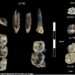 Missing chapter of human evolution revealed in 2.8-million-year-old teeth
