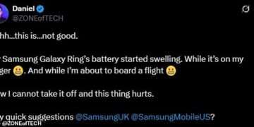 Samsung Galaxy Ring wearer is hospitalised and denied boarding onto a flight after the battery in his device started SWELLING
