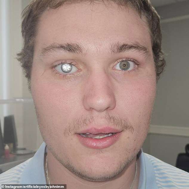 A real-life Bond villain! Jewellery store owner has a 2-carat DIAMOND embedded into his artificial eye