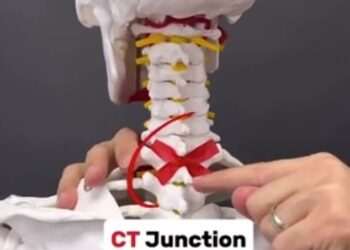 Physio shares tip to get rid of unsightly neck hump caused by slouching and too much screen time