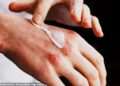 Eczema cream sold on Amazon urgently recalled because it is tainted with deadly bacteria