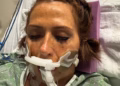 Multiple cases of deadly flesh-eating bacteria reported in southern US… as experts warn of rise ahead of summer