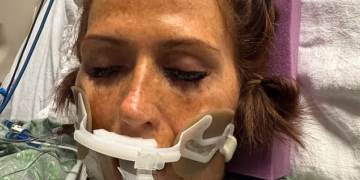 Multiple cases of deadly flesh-eating bacteria reported in southern US… as experts warn of rise ahead of summer