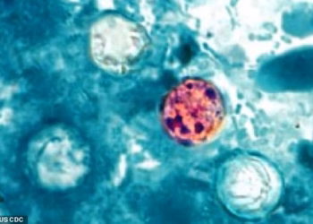 First deaths from parasite that causes ‘explosive’ symptoms reported in Michigan… as cases in the state top 11,000
