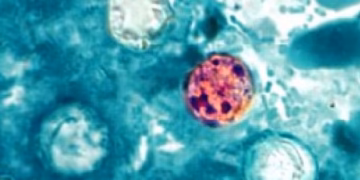First deaths from parasite that causes ‘explosive’ symptoms reported in Michigan… as cases in the state top 11,000